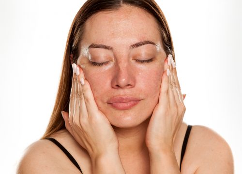 Photo of a woman with her eyes closed and her hands on her cheeks. She has visible discoloration on her face.