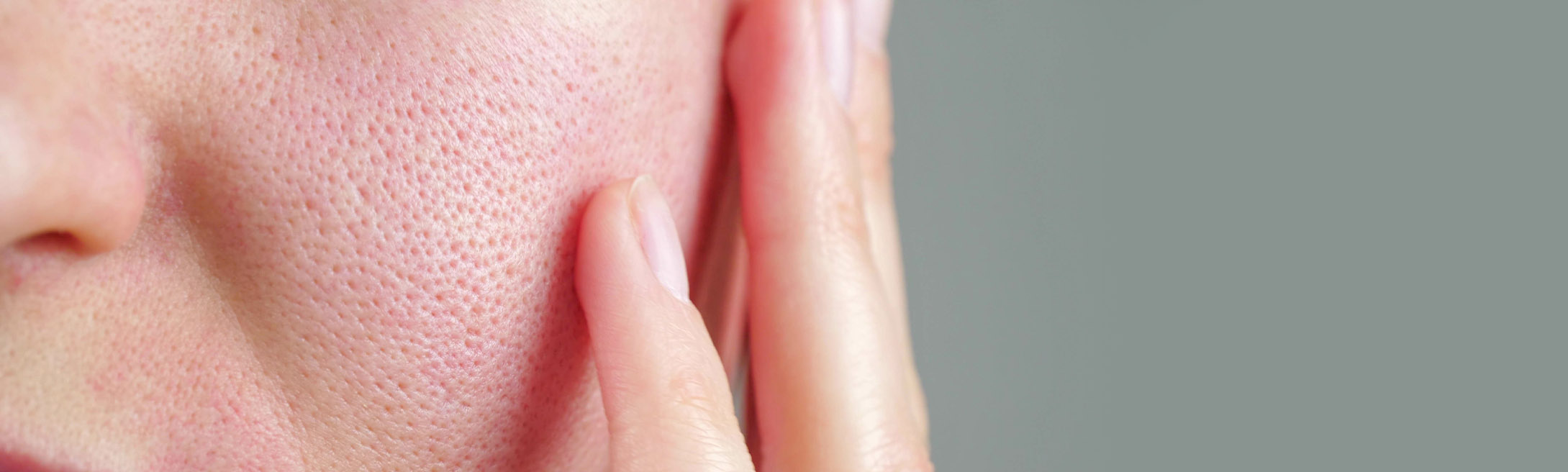 Large Pores