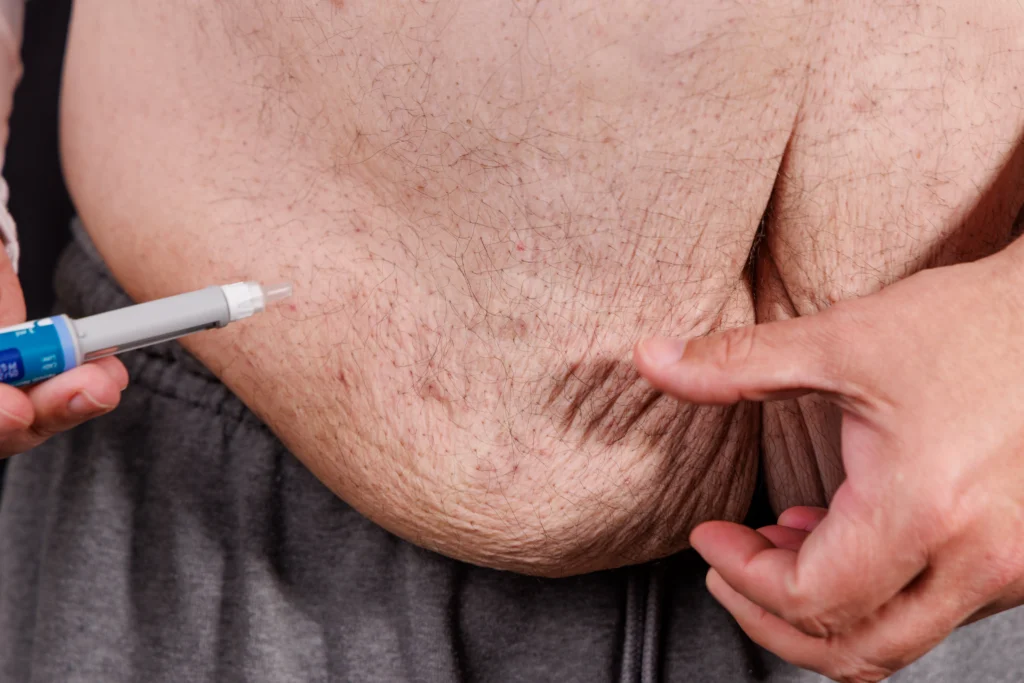 Person pinching abdominal skin while preparing injection with pen device
