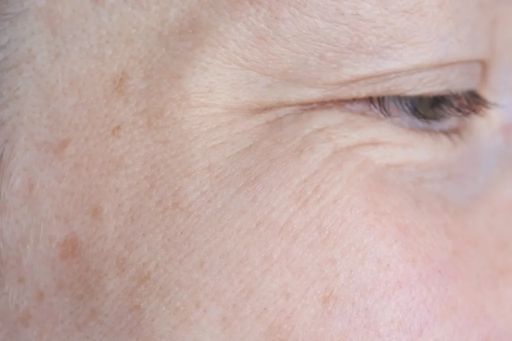 Close-up of skin around a closed eye showing fine lines and texture.