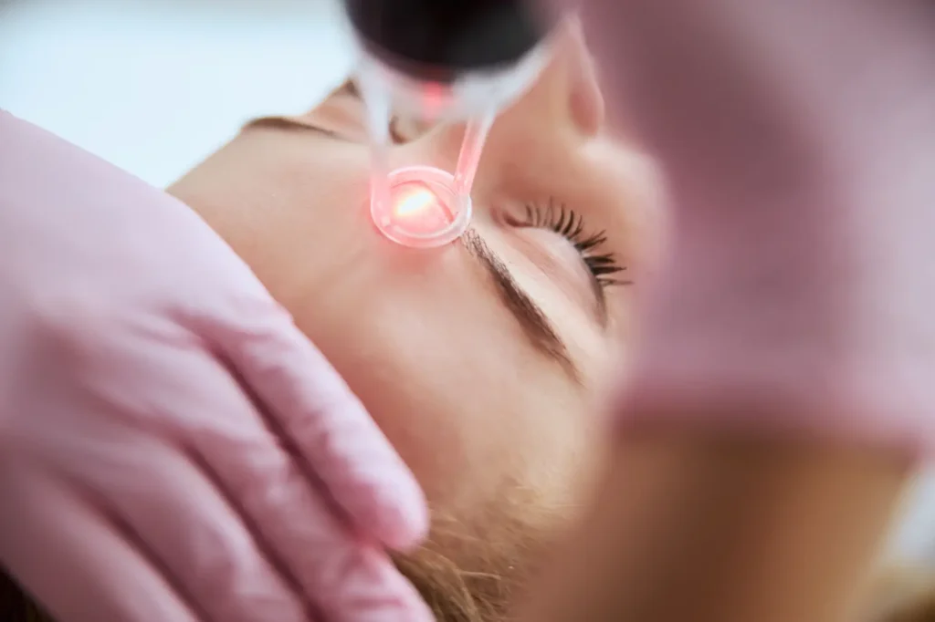 Close-up of a laser device emitting red light near a woman's forehead during a facial treatment.