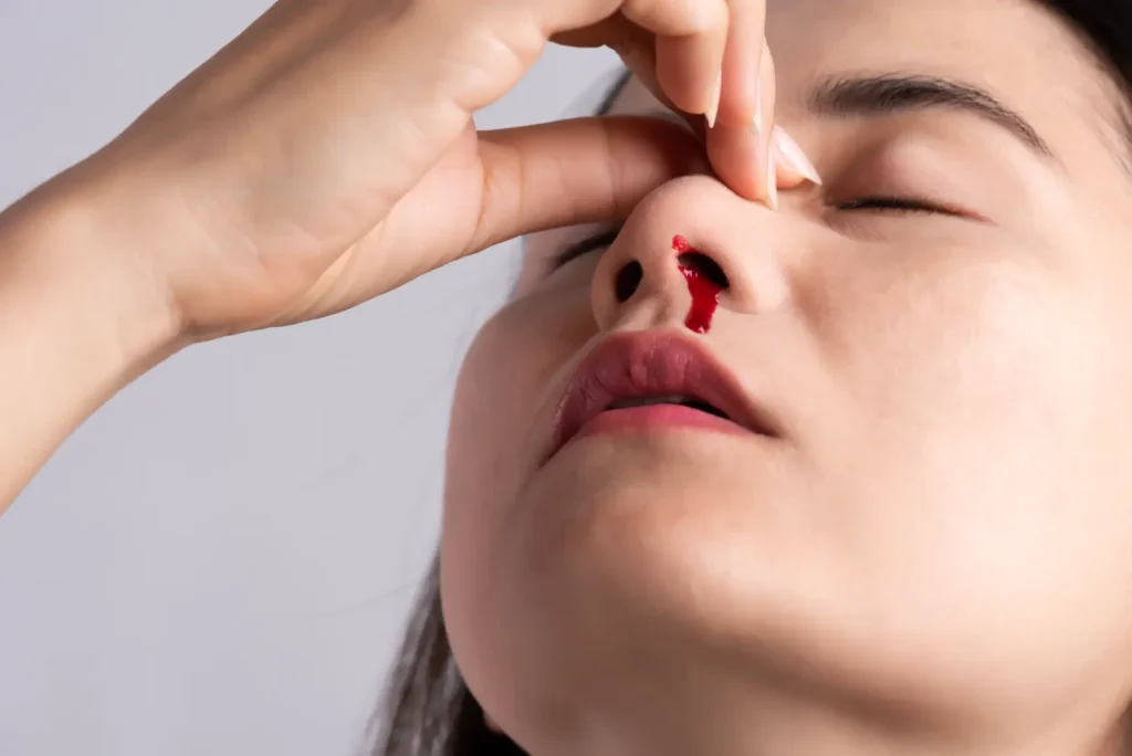 Close-up of a person pinching their nose, with blood visible below one nostril.
