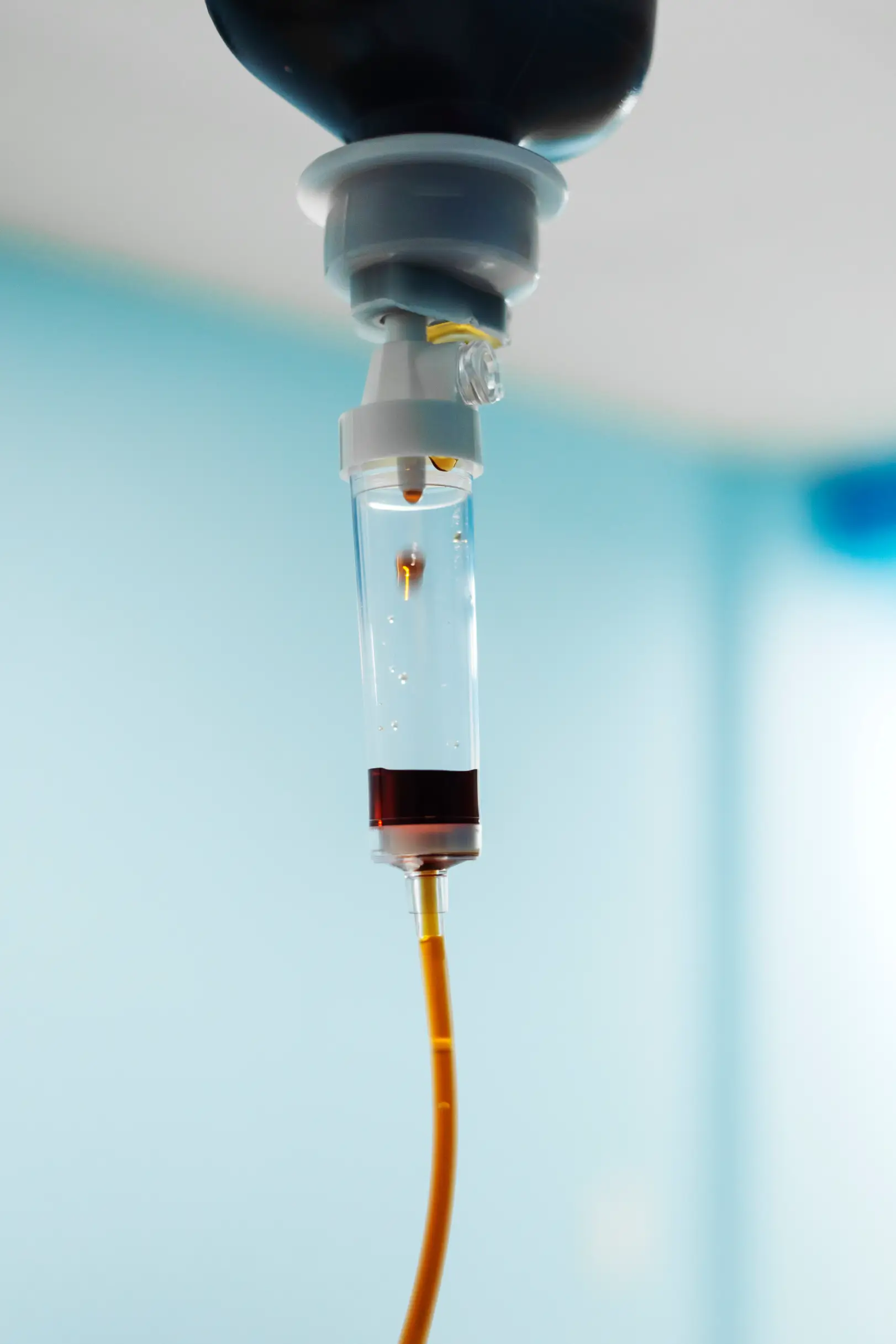 IV Iron Infusion vs. Iron Supplements: When a Doctor Recommends the Drip