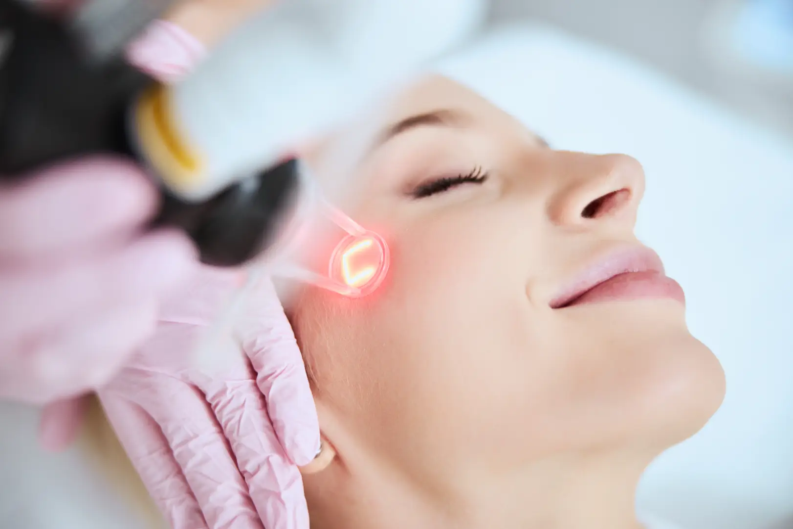 CO2 Laser for Acne Scars and Texture: What Physician-Run Resurfacing Involves