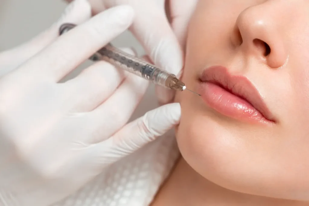 Gloved practitioner positions a syringe near a woman's upper lip during an injectable procedure.