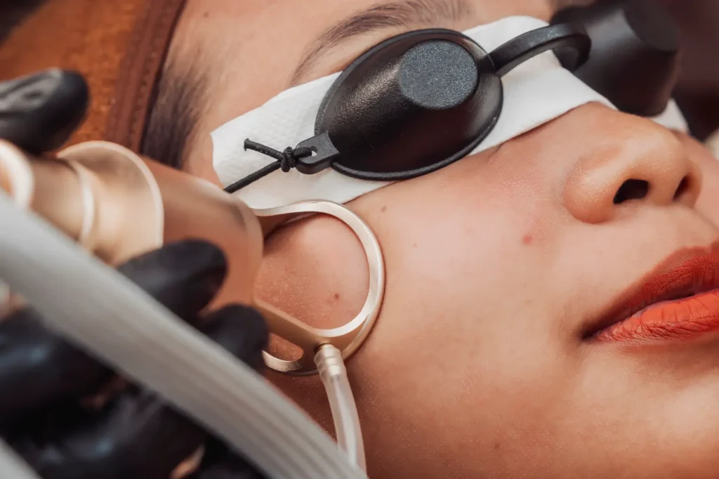 Woman wears black eye shields while a gloved hand holds a metal device beside her cheek.